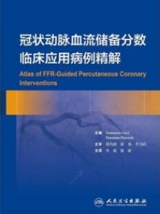 冠状动脉血流储备分数临床应用病例精解