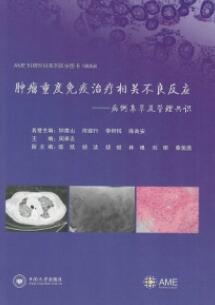 肿瘤重度免疫治疗相关不良反应 病例集萃及管理共识