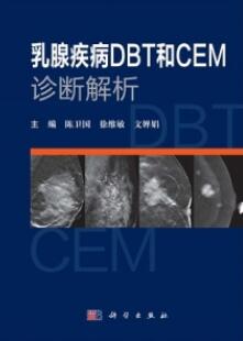 乳腺疾病DBT和CEM诊断解析