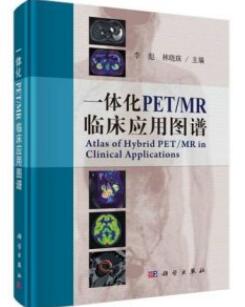 一体化PET MR临床应用图谱