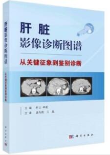 肝脏影像诊断图谱 从关键征象到鉴别诊断