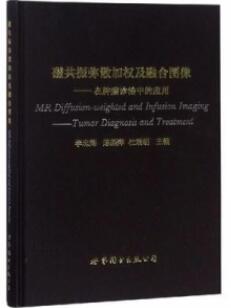 磁共振弥散加权及融合图像 在肿瘤诊治中的应用