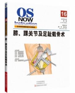 日本骨科新标准手术图谱 膝、踝关节及足趾截骨术