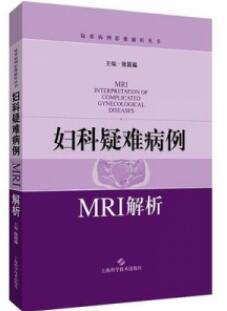 妇科疑难病例MRI解析