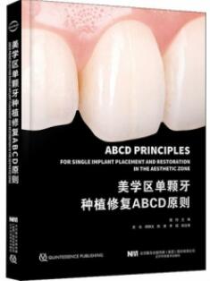 美学区单颗牙种植修复ABCD原则_撒悦主编2022年（彩图）