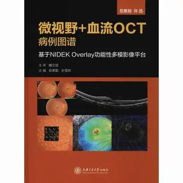 微视野＋血流OCT病例图谱 基于NIDEK Overlay功能性多