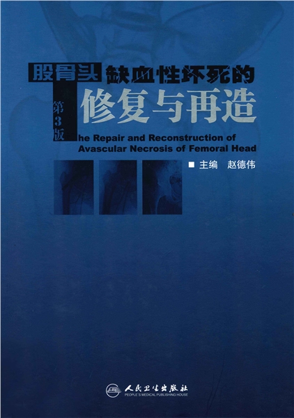 股骨头缺血性坏死的修复与再造 第3版