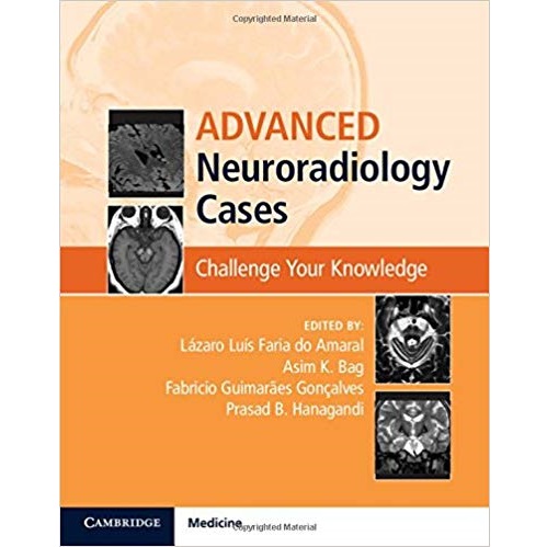 Advanced Neuroradiology Cases（高级神经放射学病例）