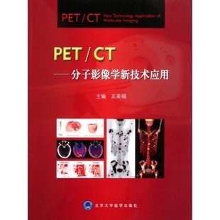 PET CT 分子影像学新技术应用