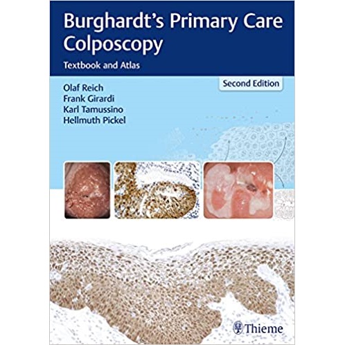 Burghardts Primary Care Colposcopy Textbook and Atlas 2nd Edition（初级保健阴道镜教材及图谱第2版）