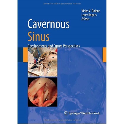 Cavernous Sinus_ Developments and Future Perspectives（海绵窦的发展与未来展望）