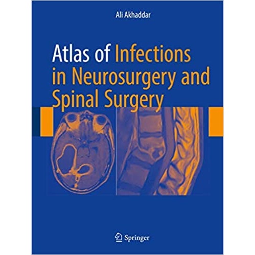 Atlas of Infections in Neurosurgery and Spinal Surgery（神经外科与脊柱外科感染图谱）