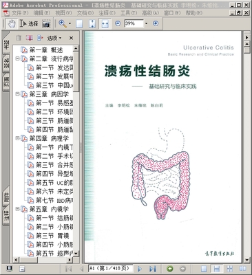 溃疡性结肠炎 基础研究与临床实践