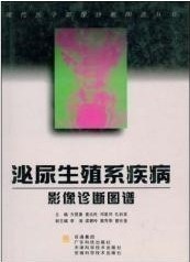 泌尿生殖系疾病影像诊断图谱 现代医学影像诊断图谱