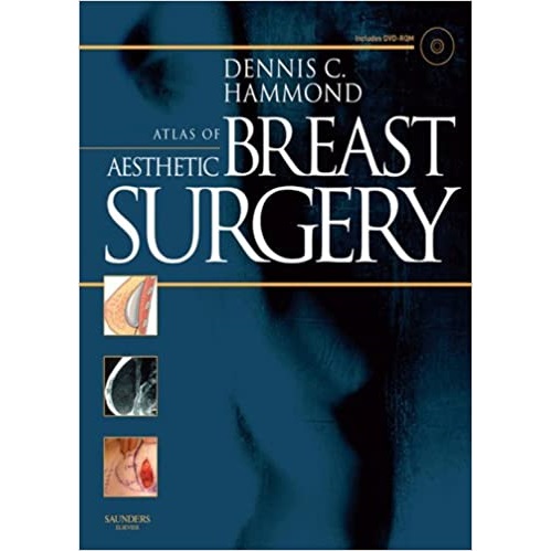 Atlas of Aesthetic Breast Surgery（美容乳房手术图谱）