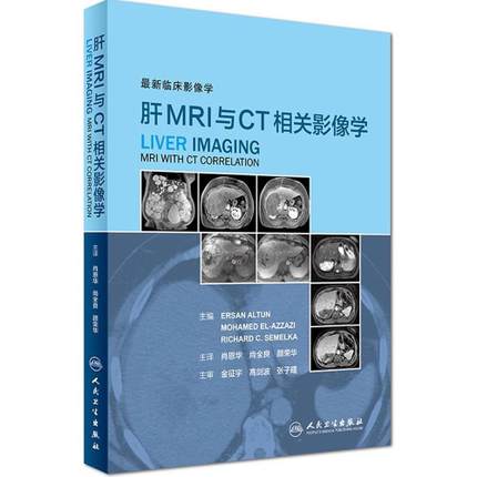 肝MRI与CT相关影像学