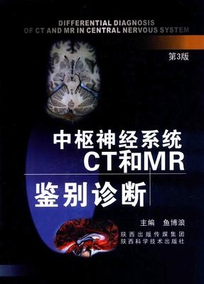 中枢神经系统CT和MR鉴别诊断 第3版
