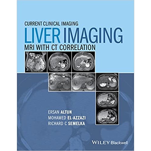 Liver Imaging  MRI with CT Correlation（肝MRI与CT相关影像学）