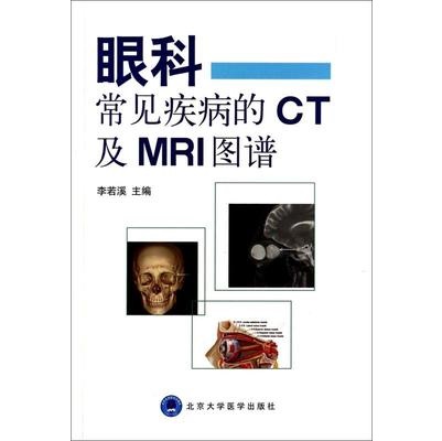 眼科常见疾病的CT及MRI图谱
