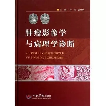 肿瘤影像学与病理学诊断