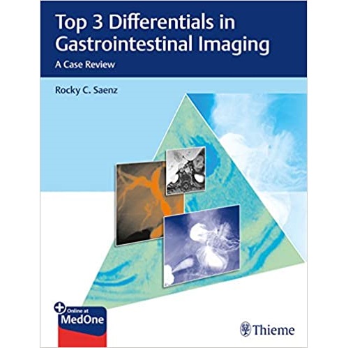 Top 3 Differentials in Gastrointestinal Imaging（胃肠道影像的前3个差异）