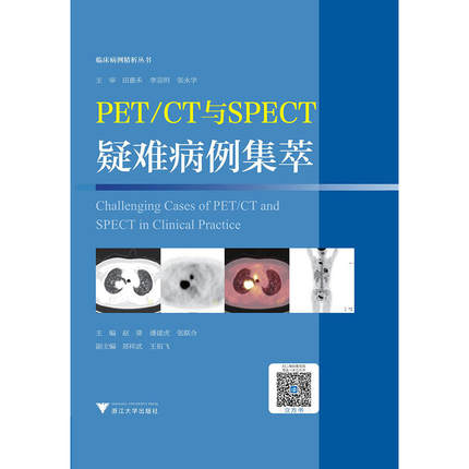 PET CT与SPECT疑难病例集萃