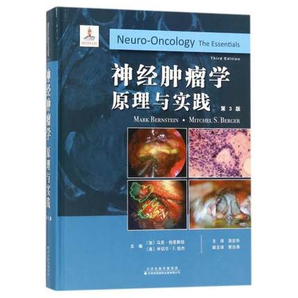 神经肿瘤学 原理与实践 第3版
