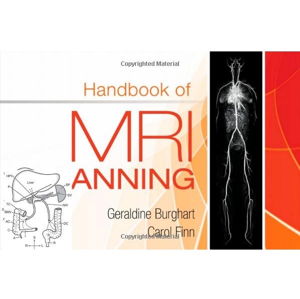 Handbook of MRI Scanning（MRI扫描手册）