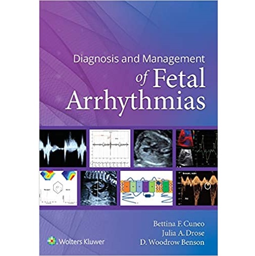 Diagnosis and Management of Fetal Arrhythmias（胎儿心律失常的诊断和处理）