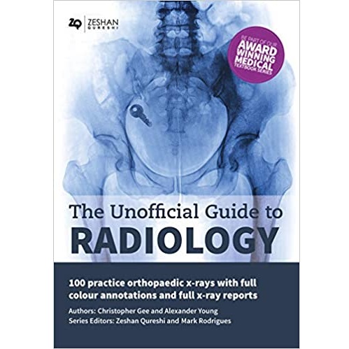 The Unofficial Guide to Radiology 100 Practice Orthopaedic X-Rays with Full Colour Annotations and Full X-Ray Reports（放射学的非官方指南100实践骨科x光与全彩色注释和完整的x光报告）