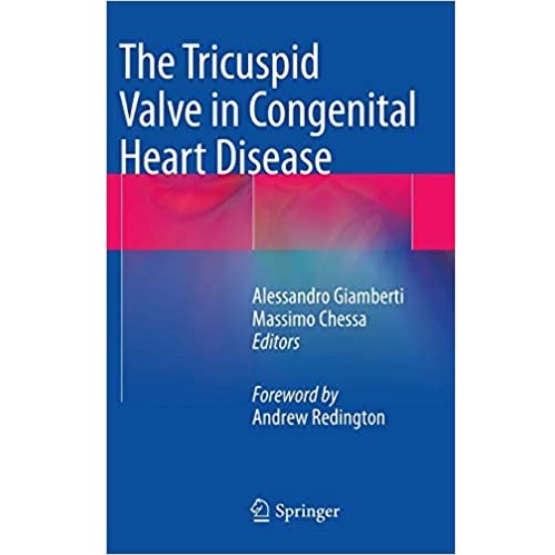 The Tricuspid Valve in Congenital Heart Disease（三尖瓣在先天性心脏病中的作用）
