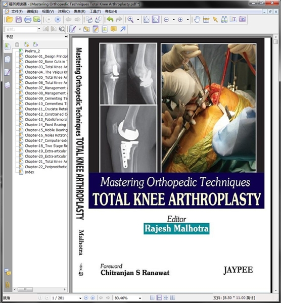 Mastering Orthopedic Techniques: Total Knee Arthroplasty