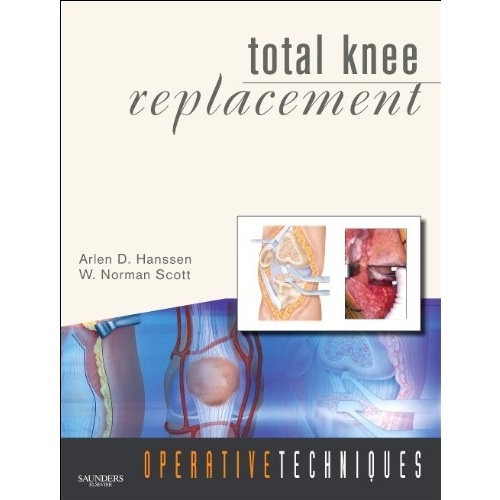 Operative Techniques: Total Knee Replacement