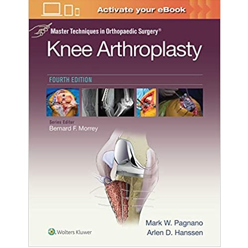 Master Techniques in Orthopedic Surgery Knee Arthroplasty 4th Edition（膝关节置换术 第四版）