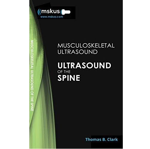 Ultrasound of the Spine 2nd Edition（脊柱超声 第2版）