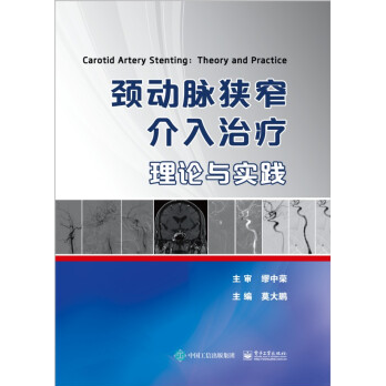 颈动脉狭窄介入治疗 理论与实践