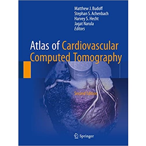 Atlas of Cardiovascular Computed Tomography 2nd Edition（心血管CT图谱 第2版）