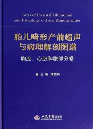 胎儿畸形产前超声与病理解剖图谱胸腔、心脏和腹部分卷