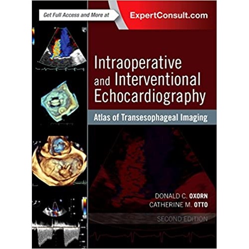 Intraoperative and Interventional Echocardiography 2nd Edition（术中及介入超声心动图 第二版）