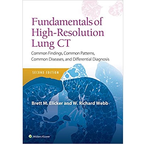 Fundamentals of High-Resolution Lung CT 2nd Edition（高分辨率肺CT基础 第二版）