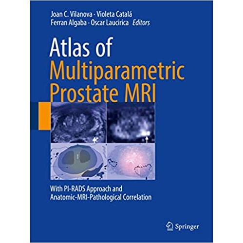 Atlas of Multiparametric Prostate MRI _ with PI-RADS Approach and Anatomic-MRI-Pathological Correlation（多参数前列腺MRI图谱 PI-RADS评分及解剖病理相关性分析）