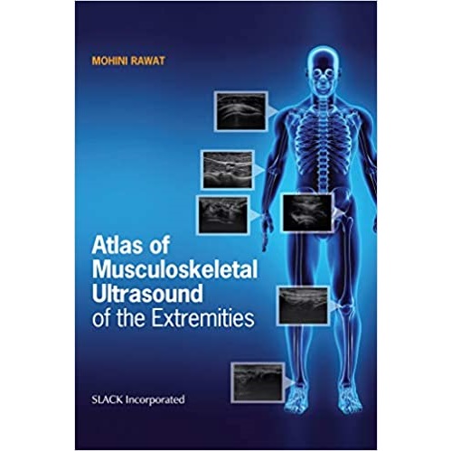 Atlas of Musculoskeletal Ultrasound of the Extremities（四肢肌肉骨骼超声图谱）