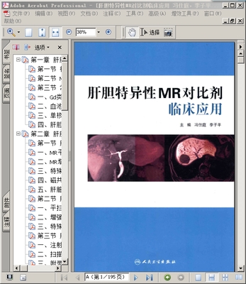 肝胆特异性MR对比剂临床应用