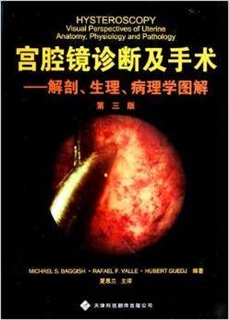 宫腔镜诊断及手术 解剖、生理、病理学图解（第三版）