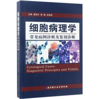 细胞病理学常见病例诊断及鉴别诊断