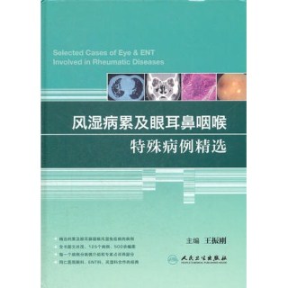 风湿病累及眼耳鼻咽喉特殊病例精选