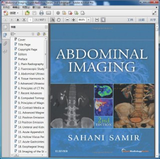Abdominal Imaging Expert Radiology Series, 2nd Edition