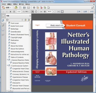 Netter"s Illustrated Human Pathology, Updated Edition