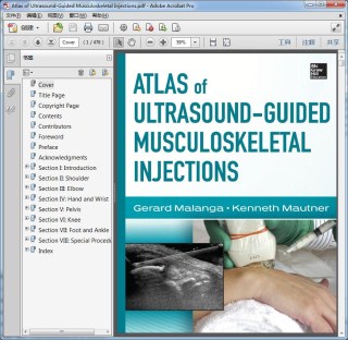 Atlas of Ultrasound-Guided Musculoskeletal Injections