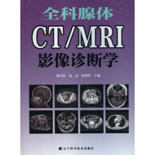 全科腺体CT MRI影像诊断学